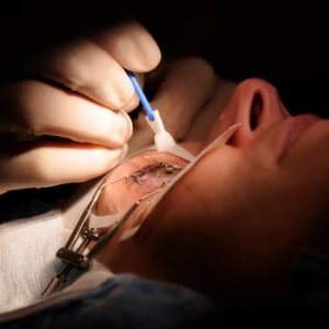 Servicio de cirugía oftálmica general: cataratas, córnea y glaucoma