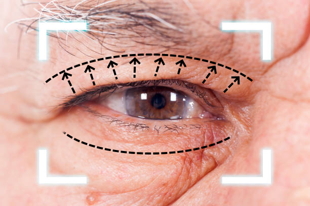 Especialistas en oculoplastia para manejo médico de párpados y áreas perioculares